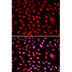 Core-Binding Factor Subunit Beta (CBFB) Antibody