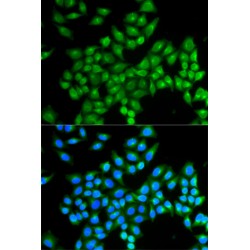 D-Amino Acid Oxidase/ DAMOX (DAO) Antibody