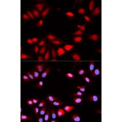 Calcipressin-1 (RCAN1) Antibody