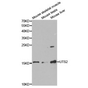 Western blot analysis of extracts of various cell lines, using UTS2 antibody (abx004077) at 1/1000 dilution.