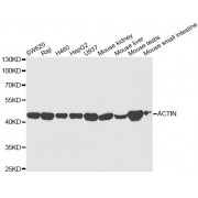 Western blot analysis of extracts of various cell lines, using ACAT1 antibody (abx004078) at 1/5000 dilution.