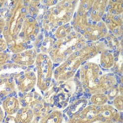 Brain-Specific Angiogenesis Inhibitor 1-Associated Protein 2 (BAIAP2) Antibody