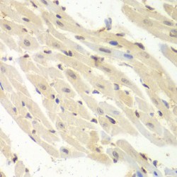 Proteasome Activator Subunit 1 (PSME1) Antibody