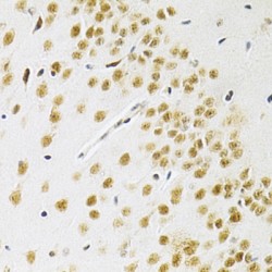 SWI/SNF Related, Matrix Associated, Actin Dependent Regulator of Chromatin, Subfamily E, Member 1 (SMARCE1) Antibody