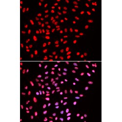 SWI/SNF Related, Matrix Associated, Actin Dependent Regulator of Chromatin, Subfamily E, Member 1 (SMARCE1) Antibody