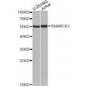 Western blot analysis of extracts of various cell lines, using SMARCE1 antibody (abx004102) at 1/1000 dilution.