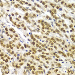 SWI/SNF Related, Matrix Associated, Actin Dependent Regulator of Chromatin, Subfamily E, Member 1 (SMARCE1) Antibody