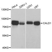 Western blot analysis of extracts of various cell lines, using CALD1 antibody (abx004107) at 1/1000 dilution.