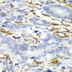 Caldesmon (CALD1) Antibody