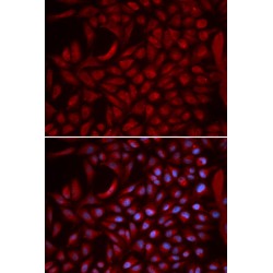 Cullin 5 (CUL5) Antibody