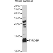 Western blot analysis of extracts of mouse pancreas, using TYROBP Antibody (abx004123) at 1:3000 dilution.