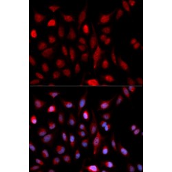 Set1/Ash2 Histone Methyltransferase Complex Subunit ASH2 (ASH2L) Antibody