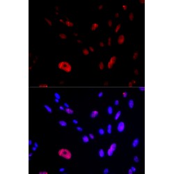 Checkpoint Protein HUS1 (HUS1) Antibody