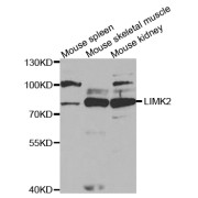 Western blot analysis of extracts of various cell lines, using LIMK2 antibody (abx004143) at 1/1000 dilution.