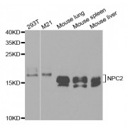 Western blot analysis of extracts of various cell lines, using NPC2 antibody (abx004147) at 1/1000 dilution.