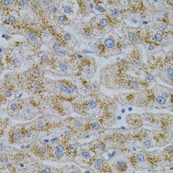 NPC Intracellular Cholesterol Transporter 2 (NPC2) Antibody