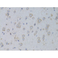 Glycyl-tRNA Synthetase (GARS1) Antibody