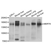 Western blot analysis of extracts of various cell lines, using MERTK antibody (abx004167) at 1/1000 dilution.