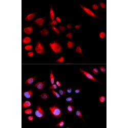 Kinesin-Like Protein KIF2C (KIF2C) Antibody