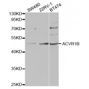 Western blot analysis of extracts of various cell lines, using ACVR1B antibody (abx004175) at 1/1000 dilution.