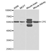 Western blot analysis of extracts of various cell lines, using CPE antibody (abx004179) at 1/1000 dilution.