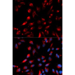 Carboxypeptidase E (CPE) Antibody