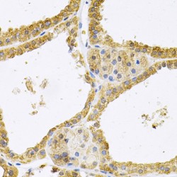 Four And A Half LIM Domains 1 (FHL1) Antibody