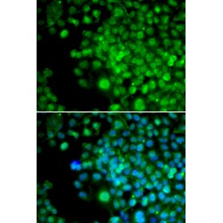 Four And A Half LIM Domains 1 (FHL1) Antibody