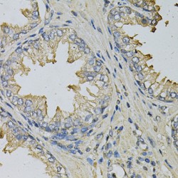 Lipopolysaccharide-Induced Tumor Necrosis Factor-Alpha Factor (LITAF) Antibody