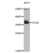 Western blot analysis of extracts of A-673 cells, using OTX2 antibody (abx004195) at 1/1000 dilution.