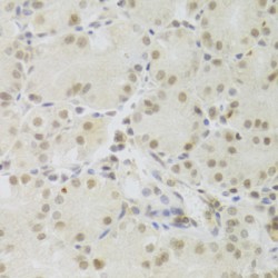 Pre-mRNA Processing Factor 3 (PRPF3) Antibody