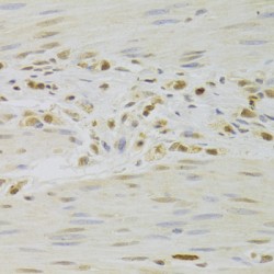 Pre-mRNA Processing Factor 3 (PRPF3) Antibody