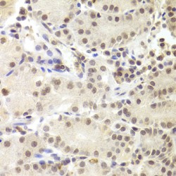 Pre-mRNA Processing Factor 3 (PRPF3) Antibody