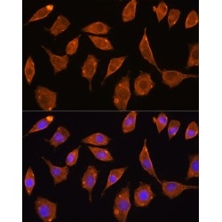 Thioredoxin Reductase 2 (TXNRD2) Antibody