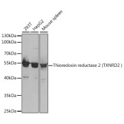 WB analysis of extracts of various cell lines, using TXNRD2 antibody (abx004207) at 1/1000 dilution.