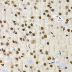 Uridine 5'-Monophosphate Synthase (UMPS) Antibody