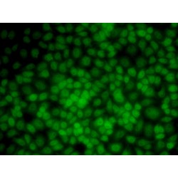 Uridine 5'-Monophosphate Synthase (UMPS) Antibody