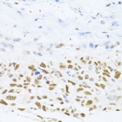 DNA Methyltransferase 1 (Dnmt1) Antibody