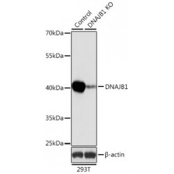 DnaJ (Hsp40) Homolog, Subfamily B, Member 1 (DNAJB1) Antibody