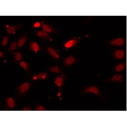 Heterogeneous Nuclear Ribonucleoprotein F (HNRNPF) Antibody