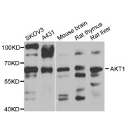 Western blot analysis of extracts of various cell lines, using AKT1 antibody (abx004230) at 1/1000 dilution.