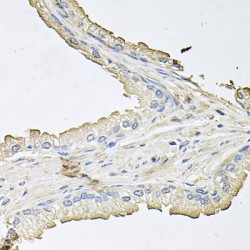 RAC-Alpha Serine/threonine-Protein Kinase (AKT1) Antibody