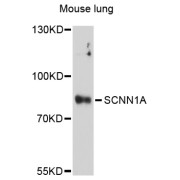 Western blot analysis of extracts of mouse lung, using SCNN1A antibody (abx004240) at 1/1000 dilution.