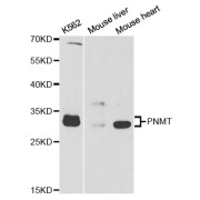 Western blot analysis of extracts of various cell lines, using PNMT antibody (abx004252) at 1/1000 dilution.