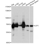 Western blot analysis of extracts of various cell lines, using LCP1 antibody (abx004260) at 1/1000 dilution.