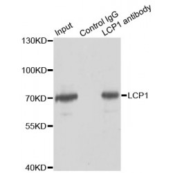 Lymphocyte Cytosolic Protein 1 (LCP1) Antibody