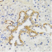 Immunohistochemistry of paraffin-embedded rat kidney using SH2B1 Antibody (abx004263) at dilution of 1/100 (40x lens).