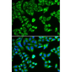 SH2B Adaptor Protein 1 (SH2B1) Antibody