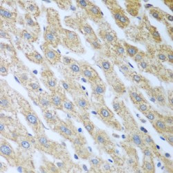 Eukaryotic Translation Initiation Factor 2 Alpha Kinase 2 (Eif2ak2) Antibody