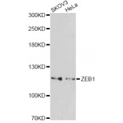 Western blot analysis of extracts of various cell lines, using ZEB1 antibody (abx004279) at 1/1000 dilution.